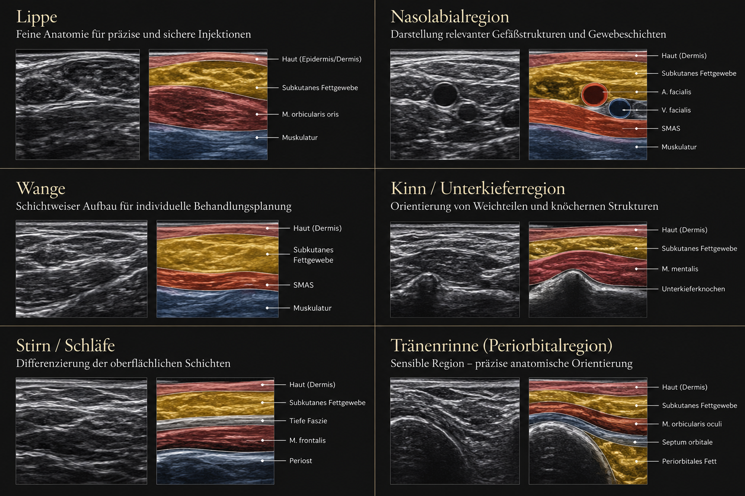 Ultraschalldarstellung anatomischer Strukturen im Gesicht