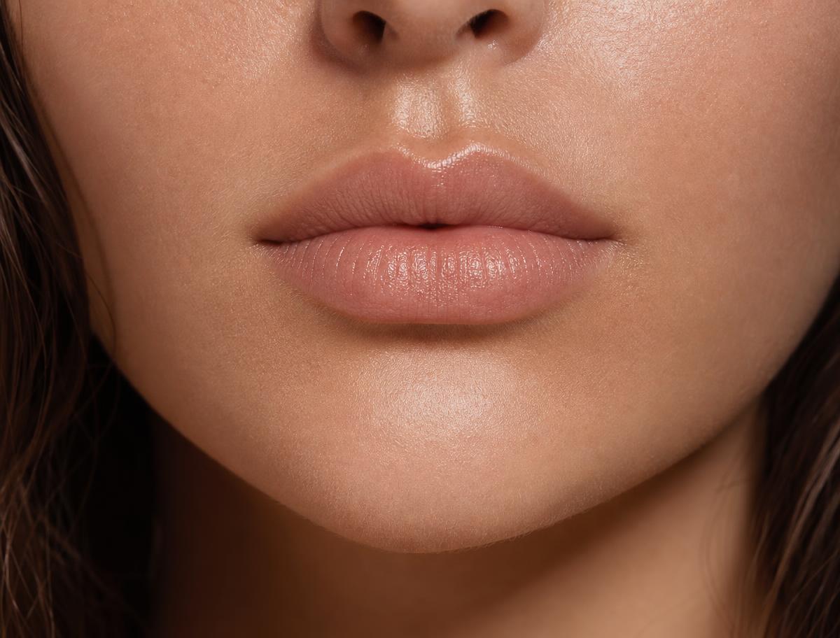 Vorher-Nachher Beispiel Lippen